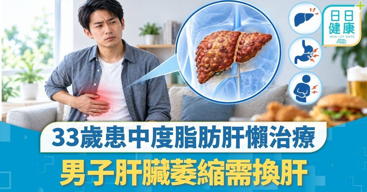 脂肪肝｜33歲患中度脂肪肝懶治療 男子肝臟萎縮需換肝 醫生推薦4款早餐扭轉脂肪肝