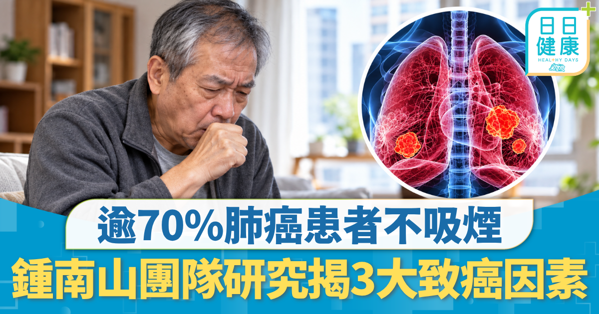 重症預防｜鍾南山團隊研究發現 逾70%肺癌患者不吸煙 3大致癌因素不容忽視