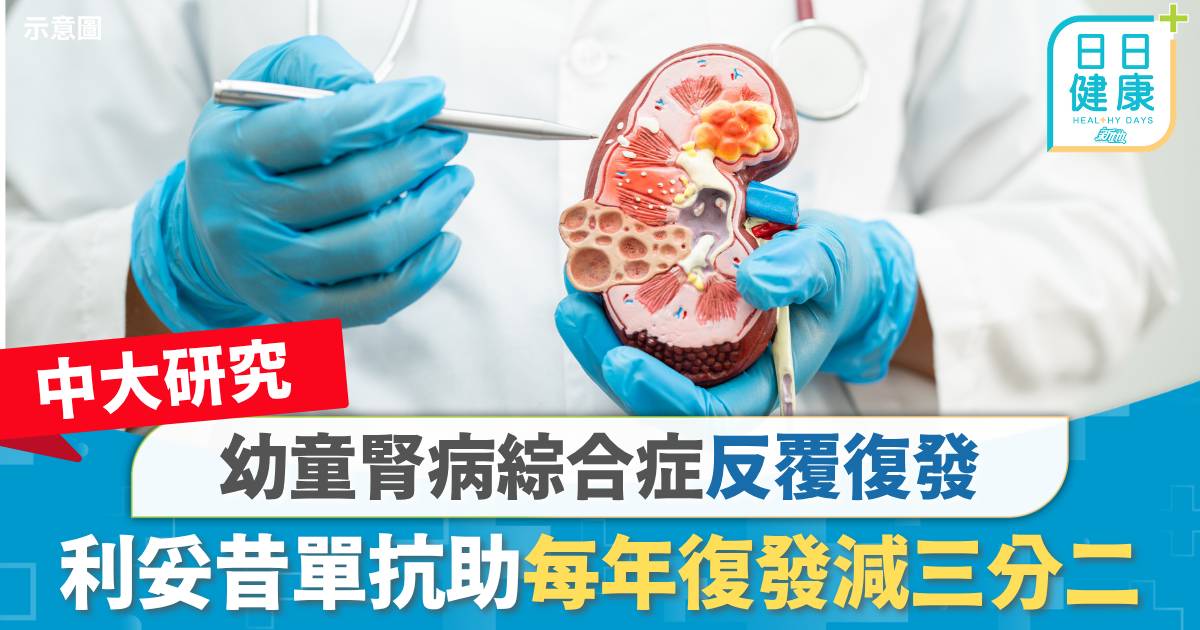 中大研究｜幼童腎病綜合症反覆復發　利妥昔單抗助每年復發減三分二